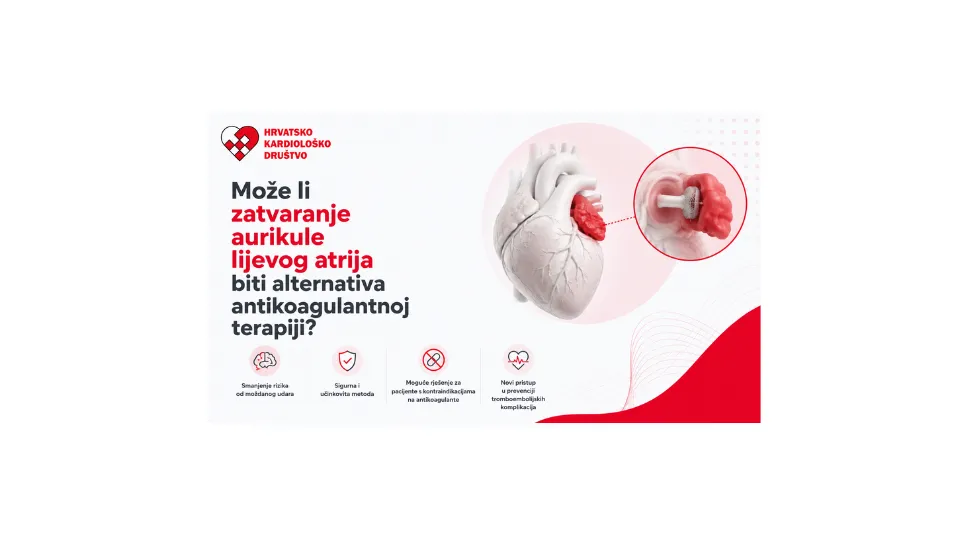 Antikoagulantna terapija nakon uspješne ablacije fibrilacije atrija: kada je sigurno razmotriti prekid?
